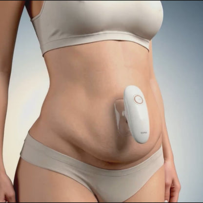SCULVERA® PRO Body RF Device